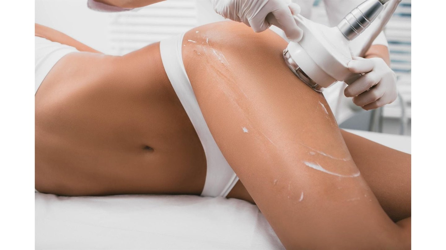 Professional vacuum massage on a woman's thigh for cellulite reduction and body contouring.