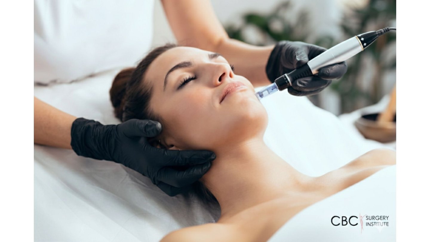 A woman receiving a professional microneedling facial treatment for skin rejuvenation at a medical spa.