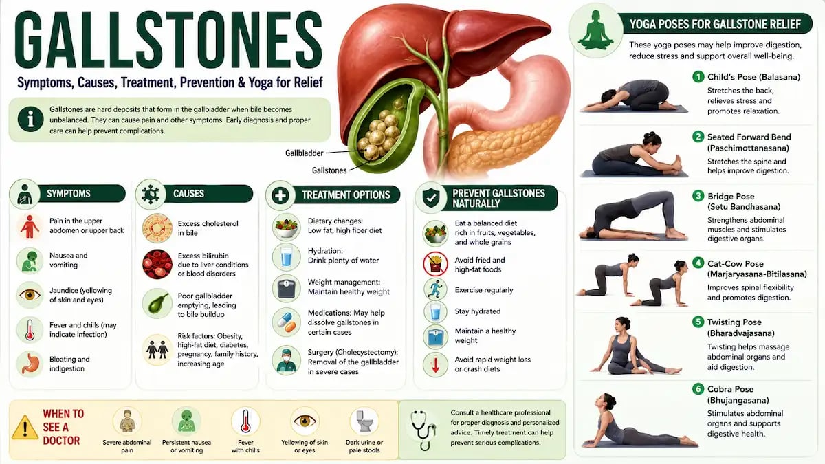 Illustration showing gallstones in the gallbladder with symptoms