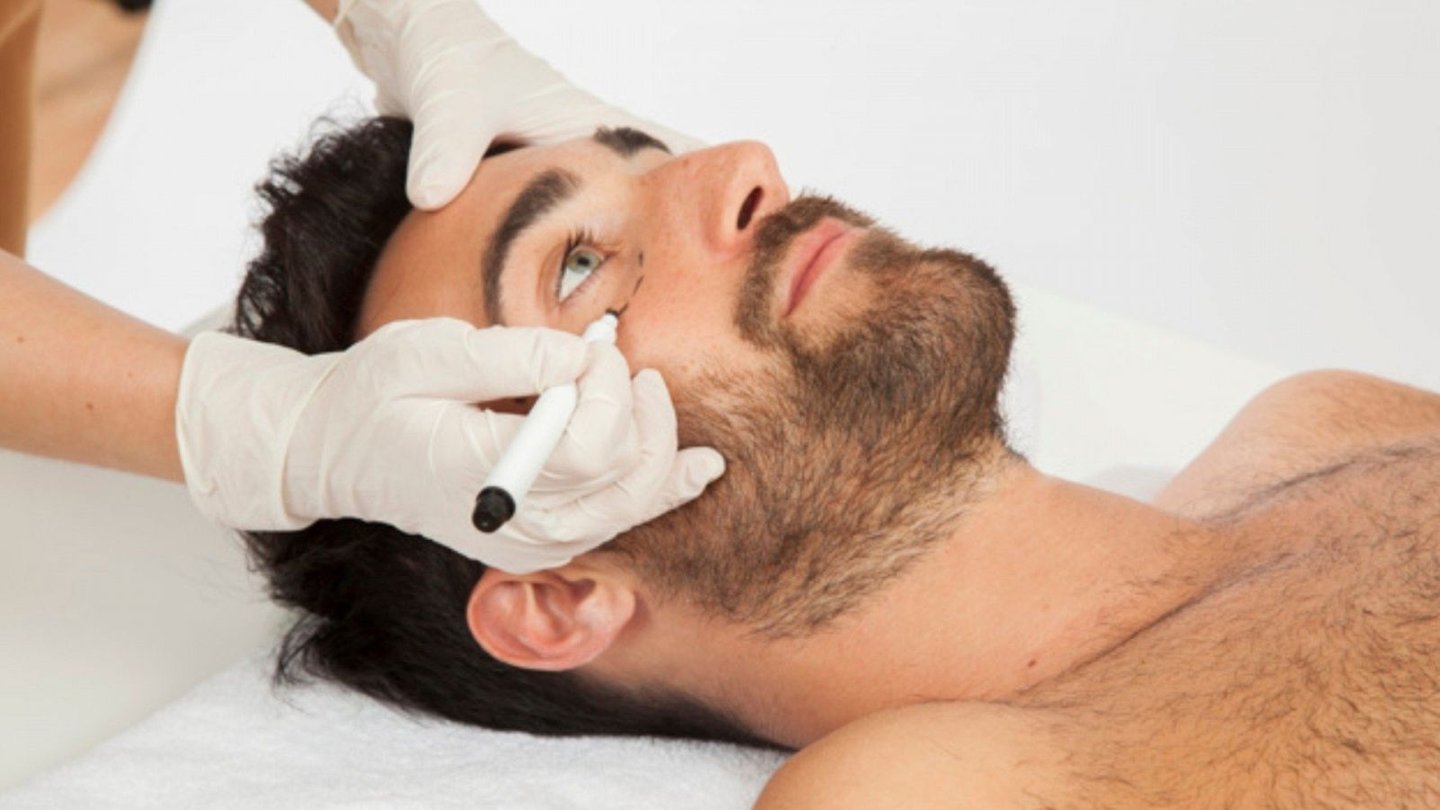 Armonización Facial en hombres clínica Beatriz Orta 