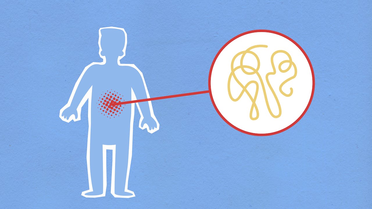 Inflammation Explained: Causes, Symptoms, and Natural Remedies for a Healthier Body