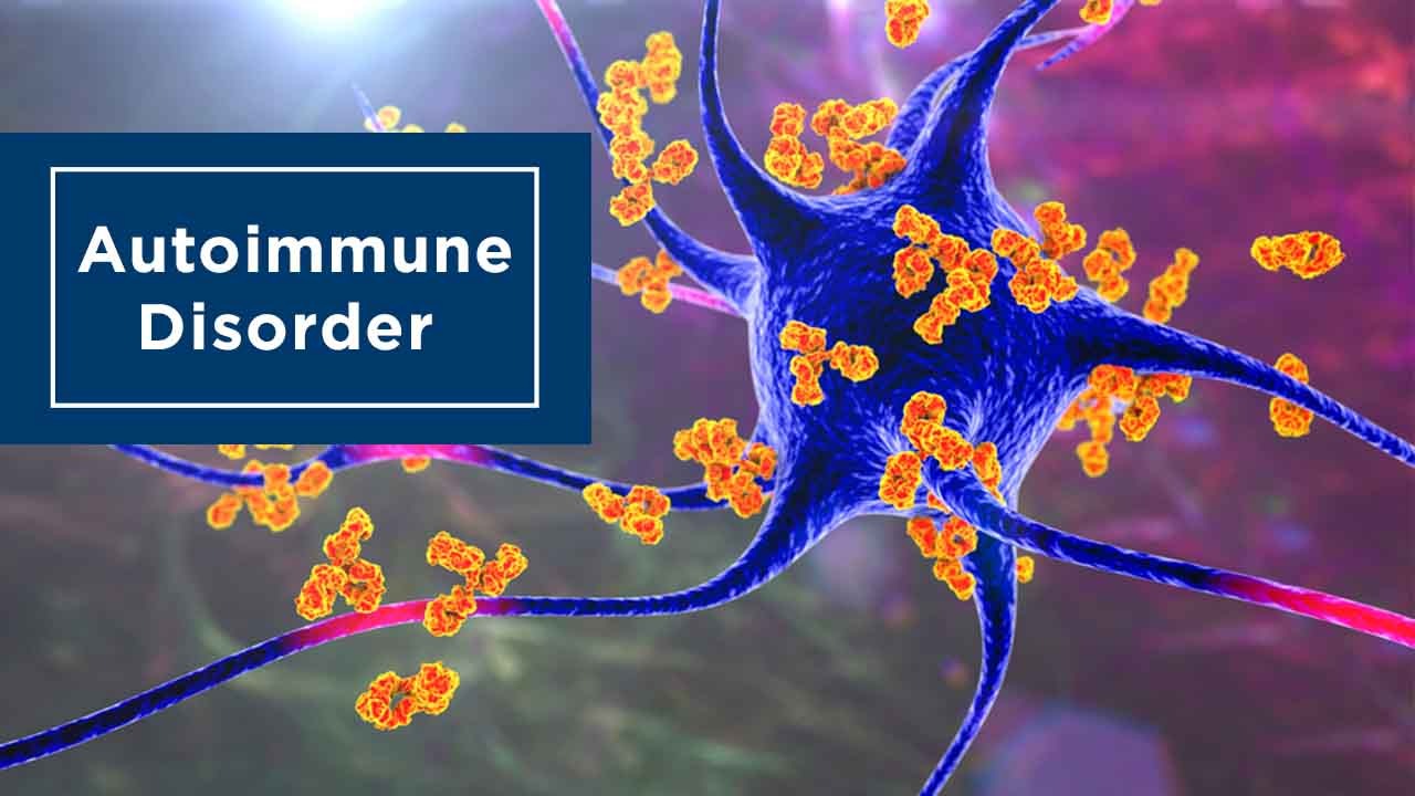 Autoimmune positive plasma