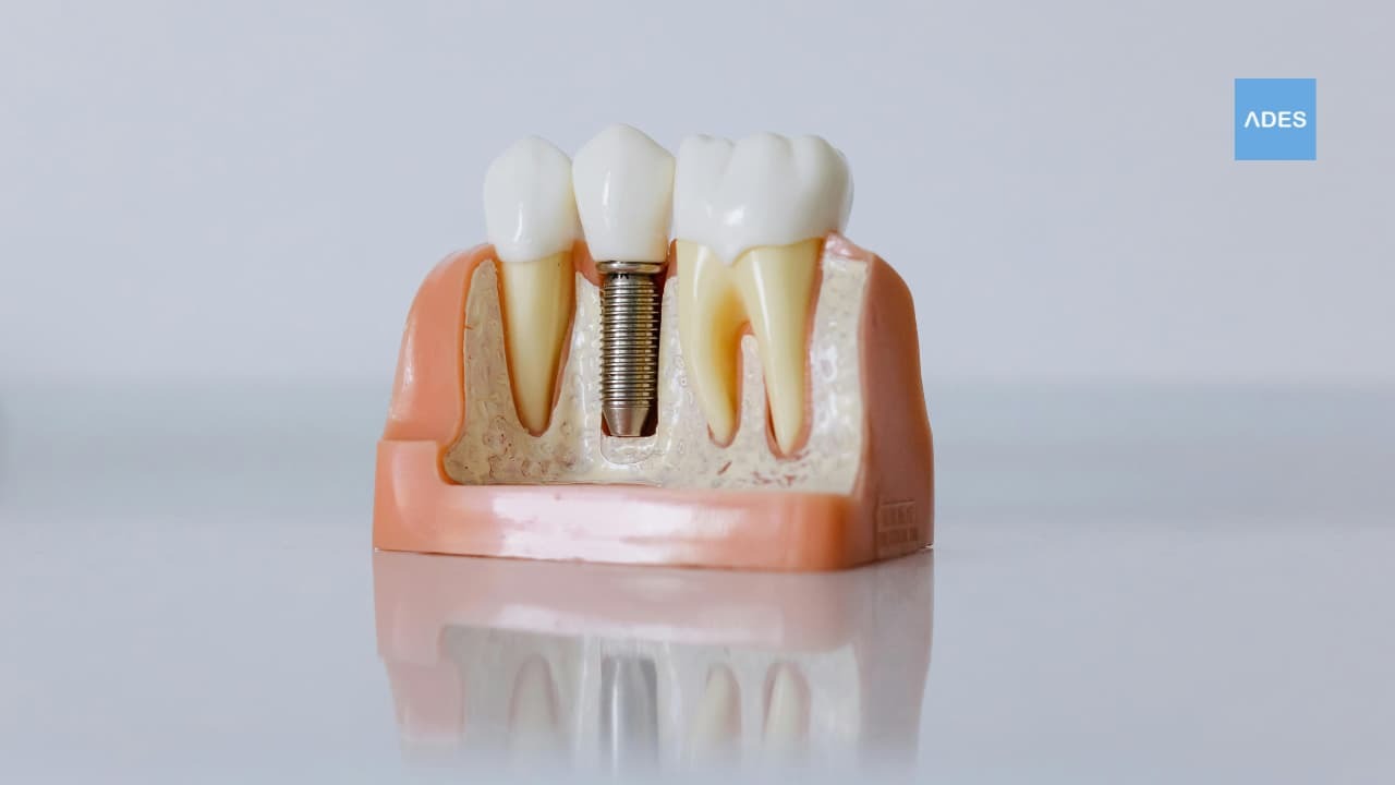 implante dental badajoz