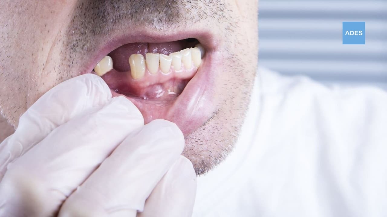 perdida diente badajoz