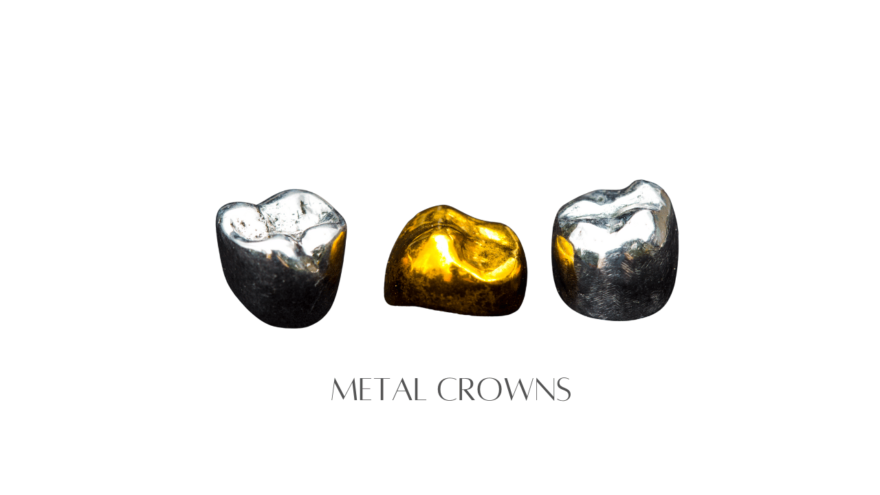 Metal Crowns
