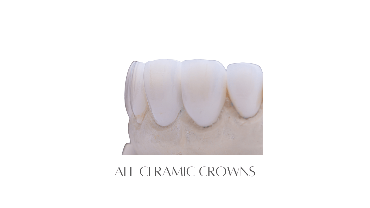 All Ceramic Crowns