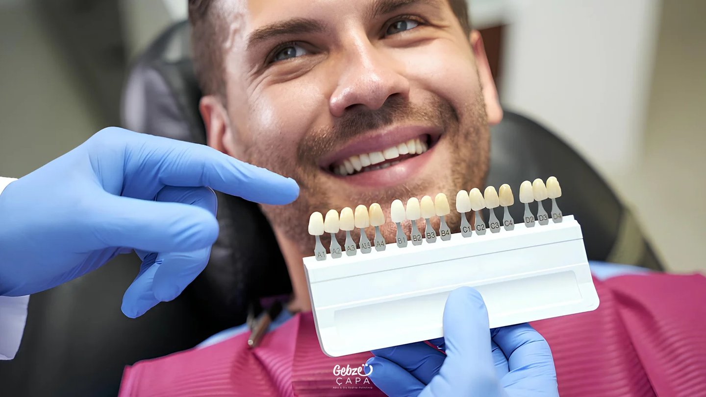 Paziente che sorride mentre si fa la prova colori per le faccette dentali