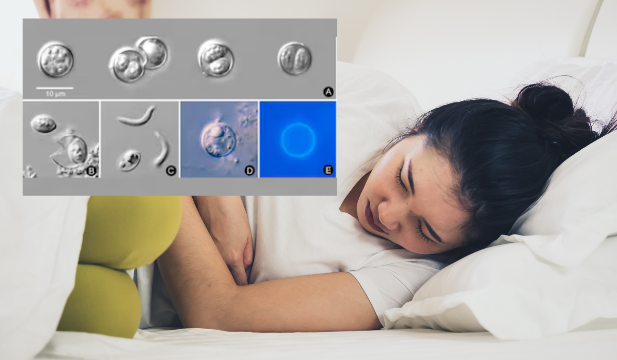 cyclosporiasis in florida