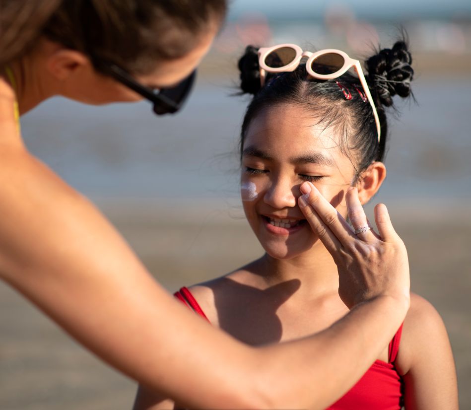 Dealing with Sunburns