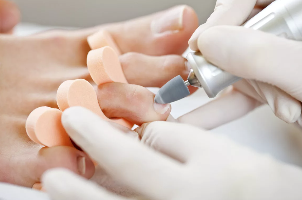 Medicininis pedikiūras 4552