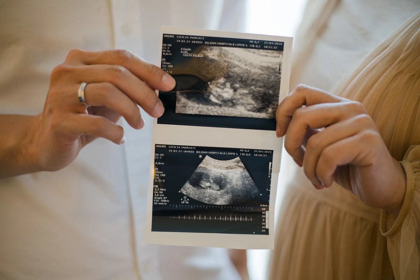 Parents holding ultrasound photos during a babymoon photography session at The Apurva Kempinski Bali