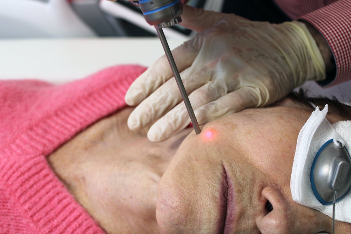 cabinet perma medical : mélasma et tâches pigmentaires