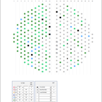 Eddy Current TSD Symbol %TWD Mapping