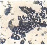 coarse-free-lime-cluster