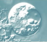 Champignon - Chytridiomycète