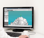 CBCT guided implant treatment planning
