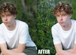 Blemishes and Scars Removal Before and After 