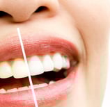 portrait-photo-retouching-teeth-whitening