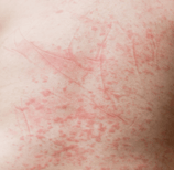 a man with a red spot on his chest and chest