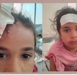 a woman with a bandage on her forehead and a bandage on her forehead