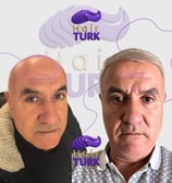 Hair transplant turkey before after