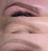first picture where done elsewhere, second picture we did laser removal, top done by us