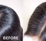 Skindent's Rejuvenate Dandruff Treatment