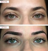 Skindent's Rejuvenate Eyebrows Microblading Services