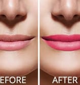 Skindent's Rejuvenate Lip Micropigmentation Services