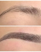 Skindent's Rejuvenate Eyebrows Microblading Services