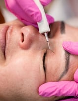 medicina estetica blefaroplastica non chirurgica rovereto trento