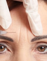 medicina estetica botox rovereto trento