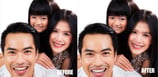 teeth-whitening
