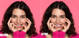 teeth-color-correction