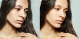 skin-refinement