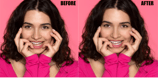 teeth-whitening-and-eye-correction