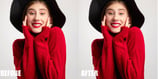teeth-whitening-and-eye-enhancement