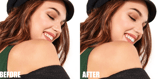 teeth-whitening