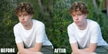 Blemishes and scars Removal