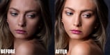 Skin Refinement
