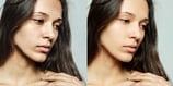 skin-refinement