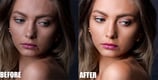 Skin Refinement Before and After 