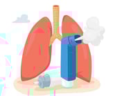 Asthma