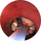 endoscopia veterinaria digestiva cuerpo extraño biopsia