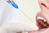 a woman is getting her teeth filled with a dermal filler