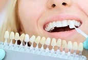 Smiling young woman with selection of the tone of the implant tooth