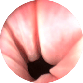 endoscopia veterinaria cistoscopia urinario
