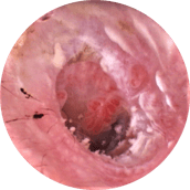 endoscopia veterinaria otoscopia oido timpano