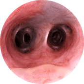 endoscopia veterinaria respiratorio traquea rinoscopia