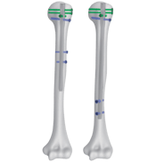 Clavo Intramedular de Húmero